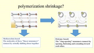 polymerization shrinkage?
 