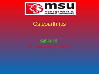 Osteoarthritis
SMS3053
Dr . Mohanad R. Alwan
 