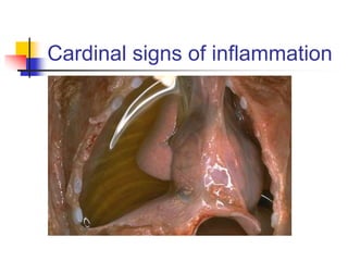 Cardinal signs of inflammation
 