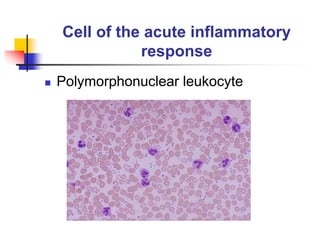 Cell of the acute inflammatory
response
 Polymorphonuclear leukocyte
 