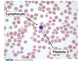 Lymphocyte
Platelets
Regents of the University of Michigan
 