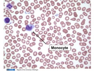 Monocyte
Regents of the University of Michigan
 