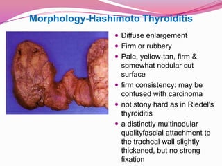 Morphology-Hashimoto ThyroiditisDiffuse enlargementFirm or rubberyPale, yellow-tan, firm & somewhat nodular cut surfacefirm consistency: may be confused with carcinomanot stony hard as in Riedel's thyroiditisa distinctly multinodularqualityfascial attachment to the tracheal wall slightly thickened, but no strong fixation