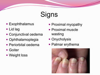 Graves' diseaseThe tall columnar thyroid epithelium lines the hyperplasticinfoldingsinto the colloid. Note the clear vacuoles in the colloid next to the epithelium.