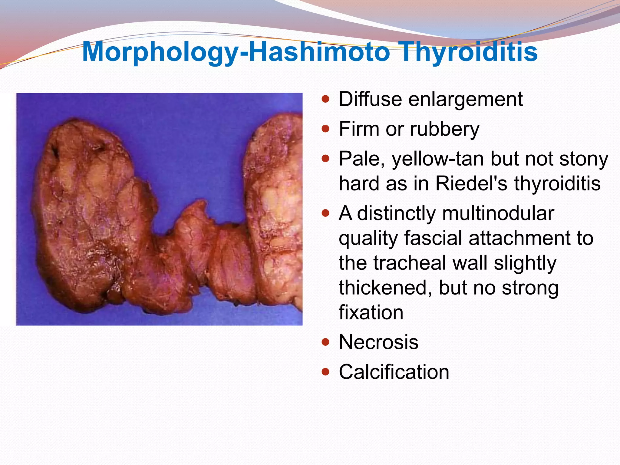 Morphology-Hashimoto Thyroiditis
 Diffuse enlargement
 Firm or rubbery
 Pale, yellow-tan but not stony
hard as in Riedel's thyroiditis
 A distinctly multinodular
quality fascial attachment to
the tracheal wall slightly
thickened, but no strong
fixation
 Necrosis
 Calcification
 