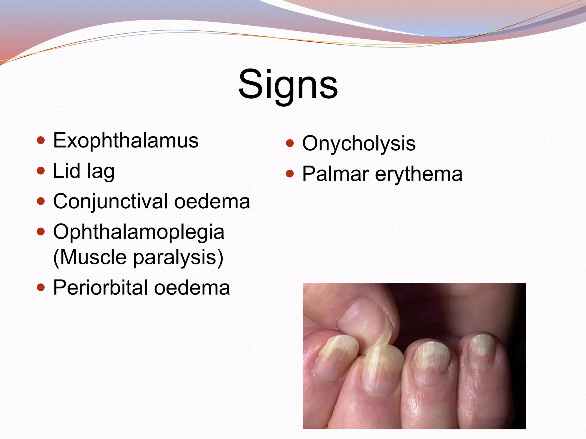 Signs
 Exophthalamus
 Lid lag
 Conjunctival oedema
 Ophthalamoplegia
(Muscle paralysis)
 Periorbital oedema
 Onycholysis
 Palmar erythema
 