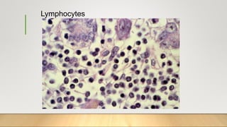 Lymphocytes
 