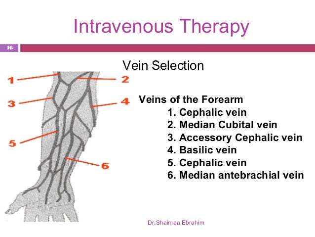 cephalic vein puncture – gothing cephalic vein puncture – gothing, Cephalic Vein