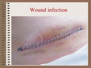Infected Incision Example Red Lect 6 wound mangement | PPT | First Aid | Injuries