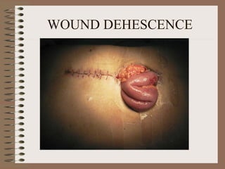 Lect 6  wound mangement