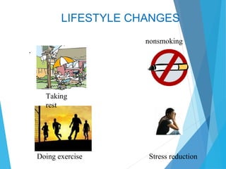 LIFESTYLE CHANGES
.
Taking
rest
nonsmoking
Stress reductionDoing exercise
 
