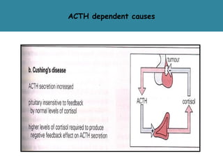 adrenal glands disorder | PPT