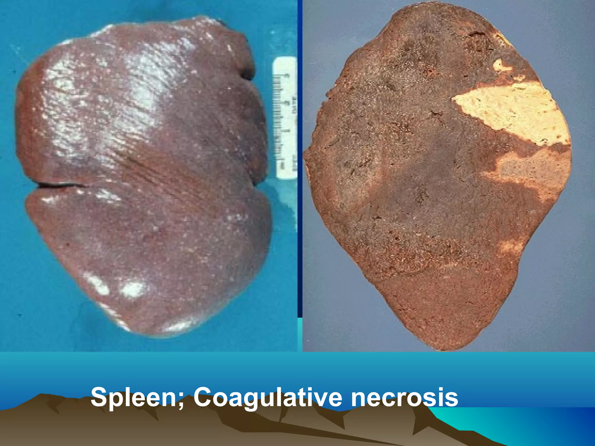 Spleen; Coagulative necrosis
 