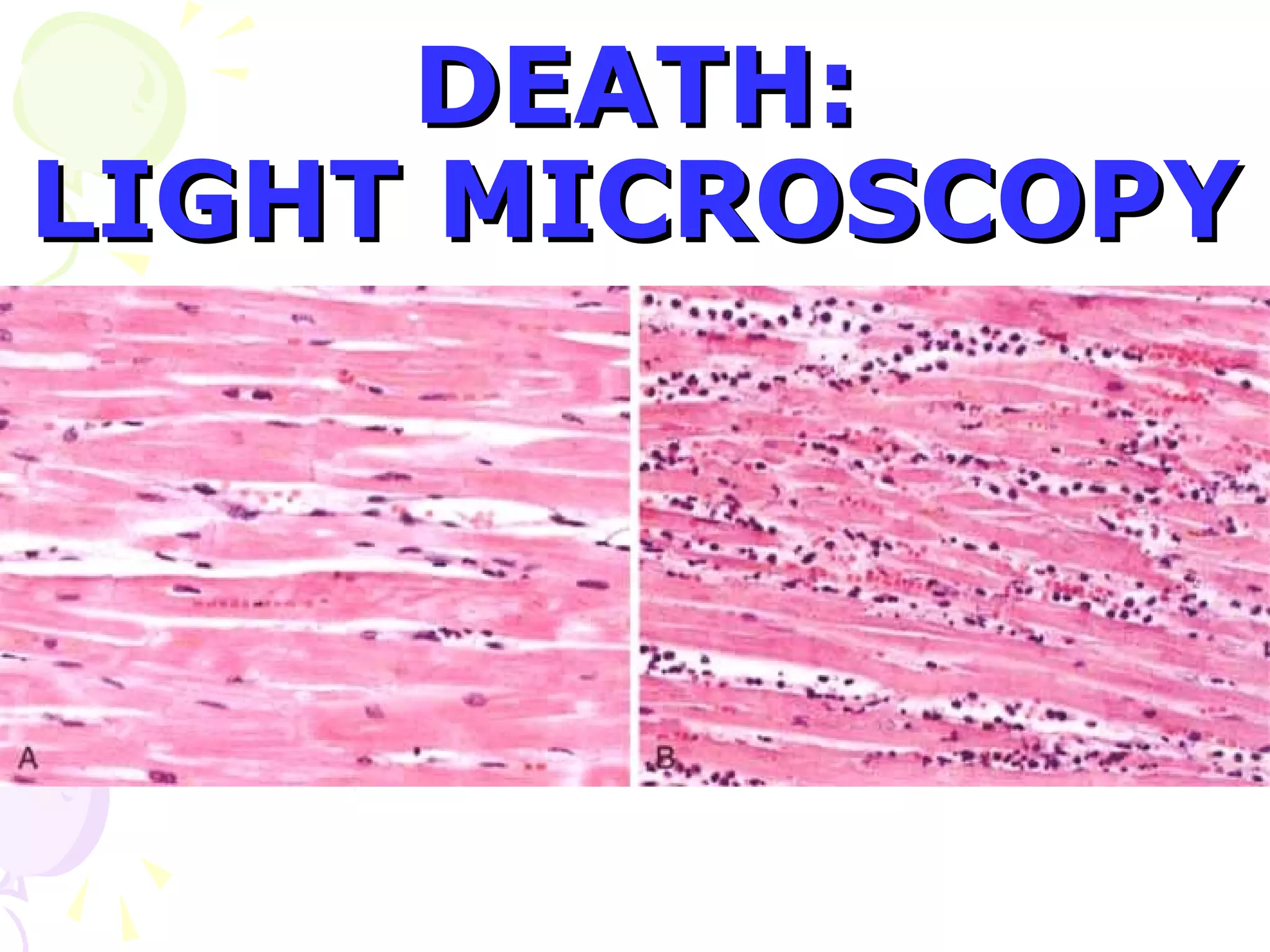 DEATH:
LIGHT MICROSCOPY
 