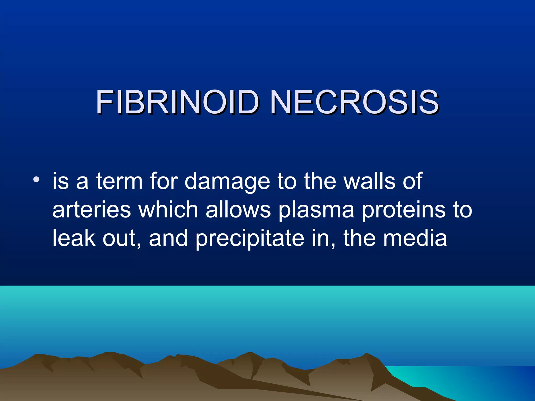 FIBRINOID NECROSIS

• is a term for damage to the walls of
  arteries which allows plasma proteins to
  leak out, and precipitate in, the media
 
