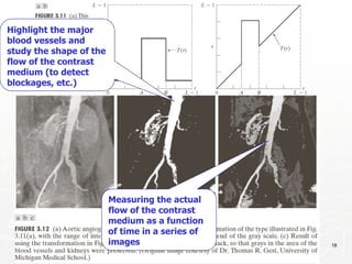 12/17/2023 18
Highlight the major
blood vessels and
study the shape of the
flow of the contrast
medium (to detect
blockages, etc.)
Measuring the actual
flow of the contrast
medium as a function
of time in a series of
images
 