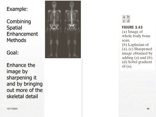 12/17/2023 86
Example:
Combining
Spatial
Enhancement
Methods
Goal:
Enhance the
image by
sharpening it
and by bringing
out more of the
skeletal detail
 