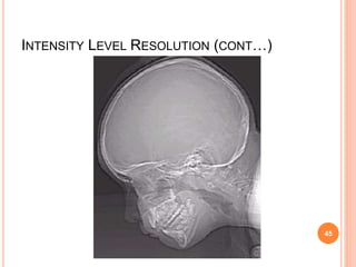 INTENSITY LEVEL RESOLUTION (CONT…)
45
 