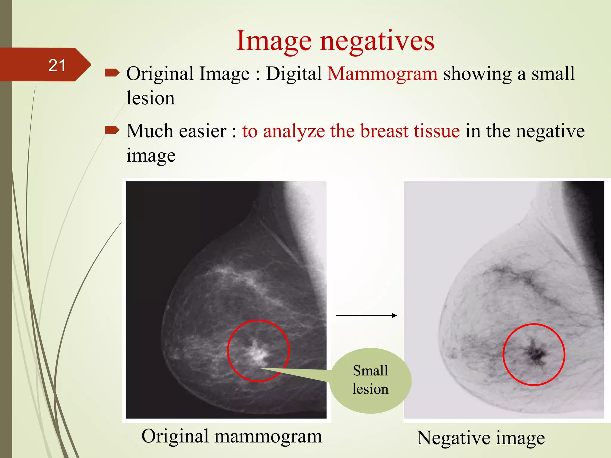 Image negatives
 Original Image : Digital Mammogram showing a small
lesion
 Much easier : to analyze the breast tissue in the negative
image
Original mammogram Negative image
Small
lesion
21
 