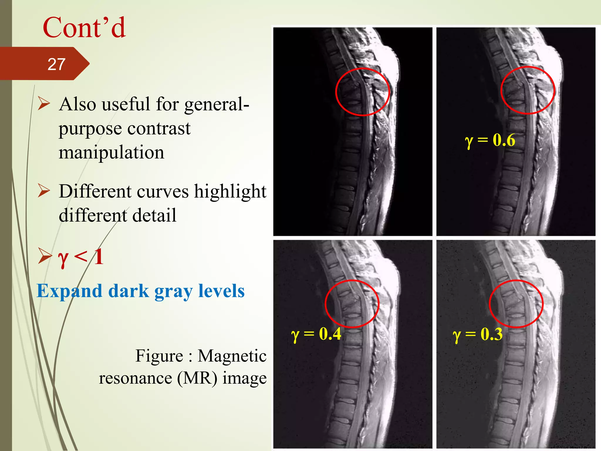 Cont’d
 Also useful for general-
purpose contrast
manipulation
 Different curves highlight
different detail
  < 1
Expand dark gray levels
 = 0.6
 = 0.4  = 0.3
Figure : Magnetic
resonance (MR) image
27
 
