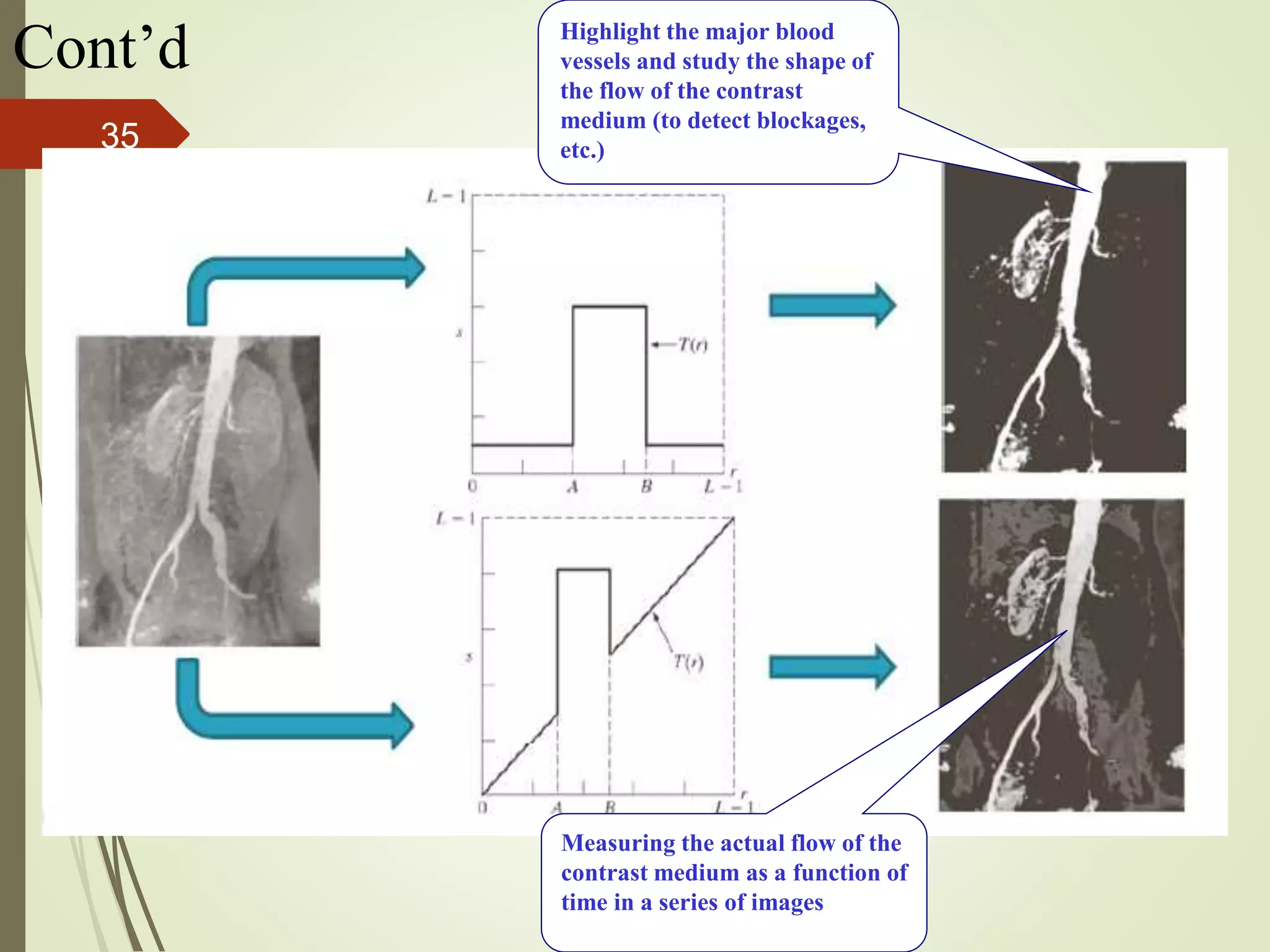 Cont’d Highlight the major blood
vessels and study the shape of
the flow of the contrast
medium (to detect blockages,
etc.)
Measuring the actual flow of the
contrast medium as a function of
time in a series of images
35
 