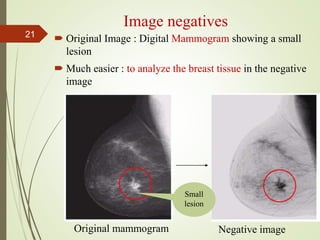 Image negatives
 Original Image : Digital Mammogram showing a small
lesion
 Much easier : to analyze the breast tissue in the negative
image
Original mammogram Negative image
Small
lesion
21
 