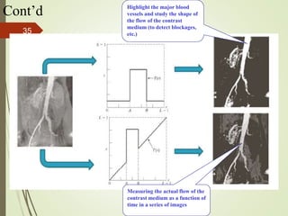 Cont’d Highlight the major blood
vessels and study the shape of
the flow of the contrast
medium (to detect blockages,
etc.)
Measuring the actual flow of the
contrast medium as a function of
time in a series of images
35
 