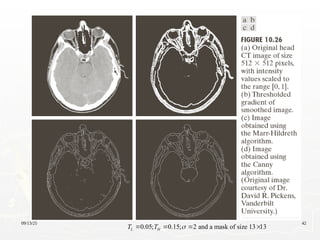 09/13/25 42
0.05; 0.15; 2 and a mask of size 13 13
L H
T T 
   
 