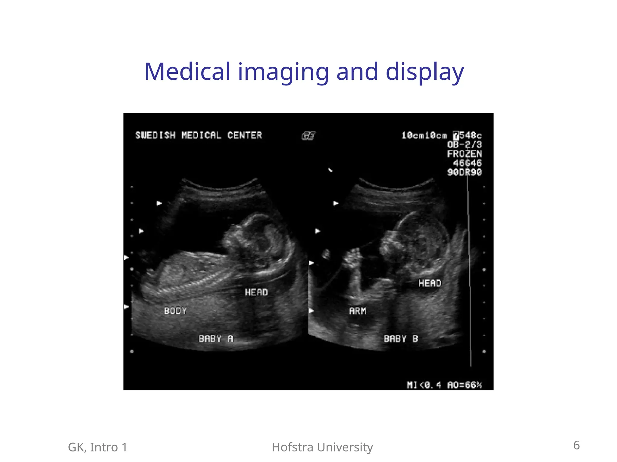 GK, Intro 1 Hofstra University 6
Medical imaging and display
 