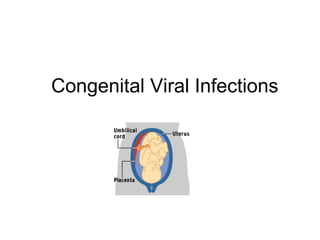 Congenital Viral Infections
 