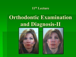 11th Lecture

Orthodontic Examination
and Diagnosis-II

 