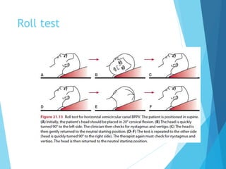Roll Wave Test lect 15 Vestibular Rehabilitation.pptx