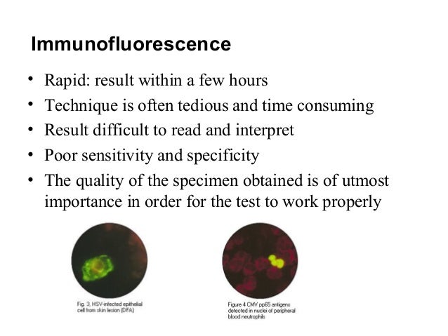 Lect 2 laboratory diagnosis of viral infections