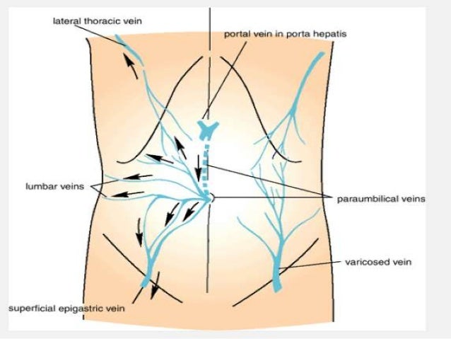 Lymphatic drainage of anterior abdominal wall Clearance