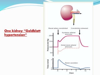 One kidney “Goldblatt
hypertension”
 