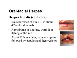 Herpes labialis (cold sore)
• Is a recurrence of oral HS in about
45% of individuals
• A prodrome of tingling, warmth or
itching at the site
• About 12 hours later, redness appears
followed by papules and then vesicles
Oral-facial Herpes
 