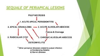 SEQUALE OF PERIAPICAL LESIONS
 