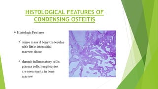 HISTOLOGICAL FEATURES OF
CONDENSING OSTEITIS
 