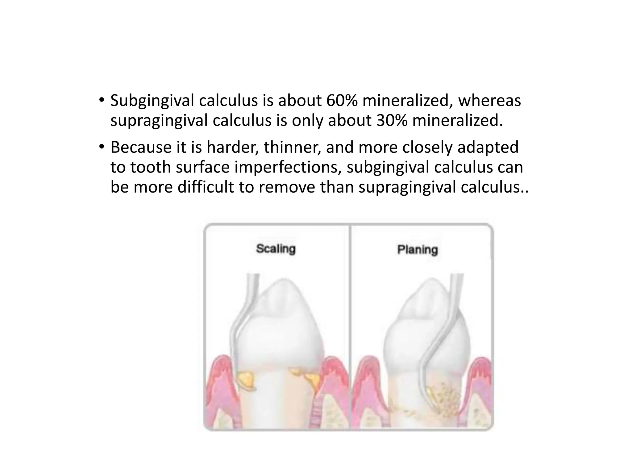 • Subgingival calculus is about 60% mineralized, whereas
supragingival calculus is only about 30% mineralized.
• Because it is harder, thinner, and more closely adapted
to tooth surface imperfections, subgingival calculus can
be more difficult to remove than supragingival calculus..
 