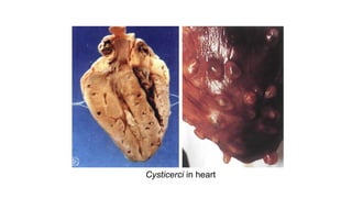 Cysticerci in heart
 