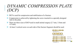 lect_7_-_Internal_fixation_-_I.pptx
