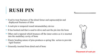 lect_7_-_Internal_fixation_-_I.pptx