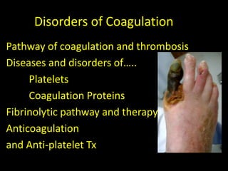 Disorders of Coagulation
Pathway of coagulation and thrombosis
Diseases and disorders of…..
Platelets
Coagulation Proteins
Fibrinolytic pathway and therapy
Anticoagulation
and Anti-platelet Tx
 