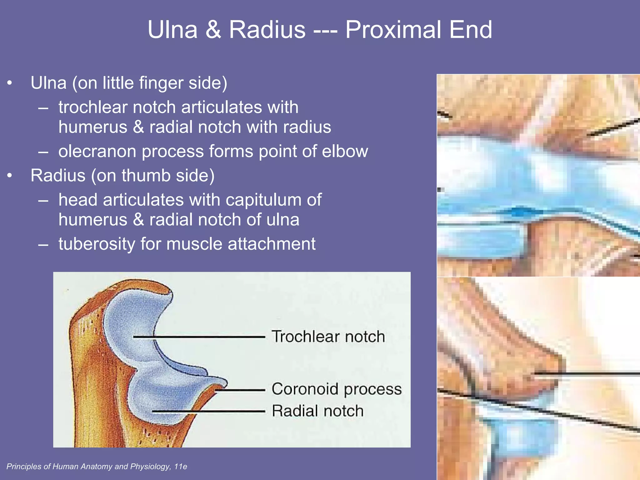 Ulna & Radius --- Proximal End Ulna (on little finger side) trochlear notch articulates with humerus & radial notch with radius olecranon process forms point of elbow  Radius (on thumb side) head articulates with capitulum of  humerus & radial notch of ulna  tuberosity for muscle attachment 