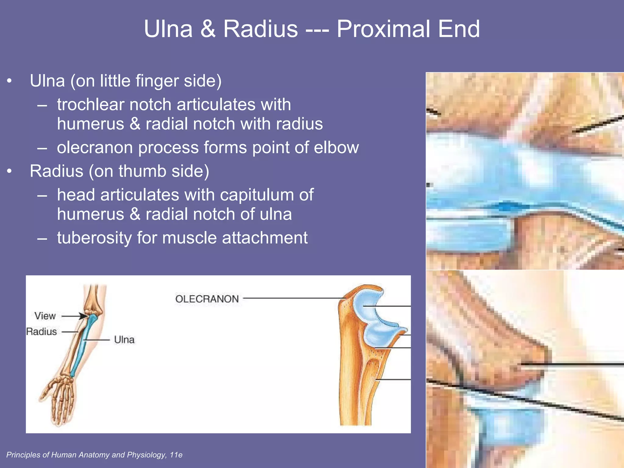 Ulna & Radius --- Proximal End Ulna (on little finger side) trochlear notch articulates with humerus & radial notch with radius olecranon process forms point of elbow  Radius (on thumb side) head articulates with capitulum of  humerus & radial notch of ulna  tuberosity for muscle attachment 