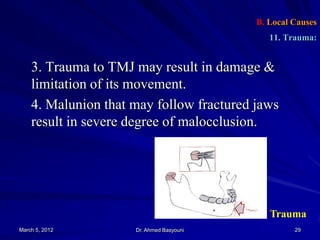 B. Local Causes
11. Trauma:

3. Trauma to TMJ may result in damage &
limitation of its movement.
4. Malunion that may follow fractured jaws
result in severe degree of malocclusion.

Trauma
March 5, 2012

Dr. Ahmed Basyouni

29

 