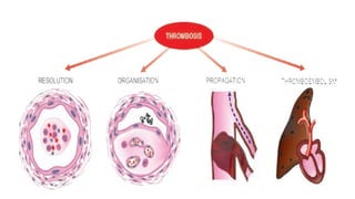 Hymodiamic Notes LECTURE CLASS NOTES 9 HEMODYNAMIC CONDITIONS.pptx