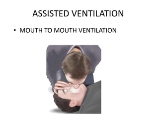 ASSISTED VENTILATION
• MOUTH TO MOUTH VENTILATION
 