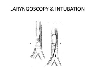 LARYNGOSCOPY & INTUBATION
 