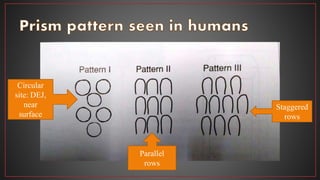 Parallel
rows
Circular
site: DEJ,
near
surface
Staggered
rows
 